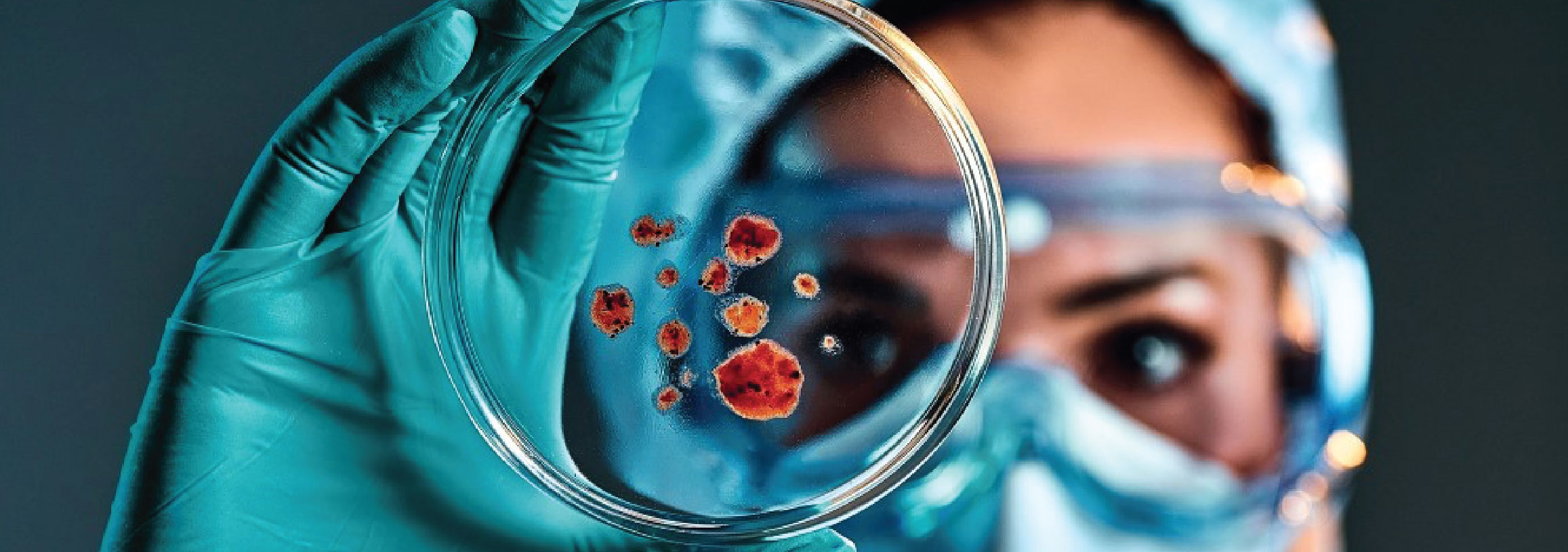 Antimicrobial resistance: A Global Threat